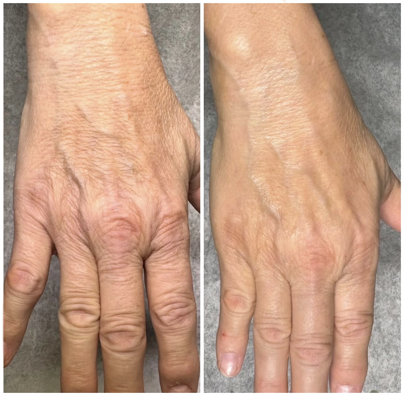 händer-resultat-nook copy